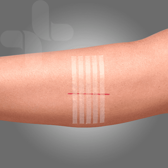 Wound Closure Strips ( various sizes )